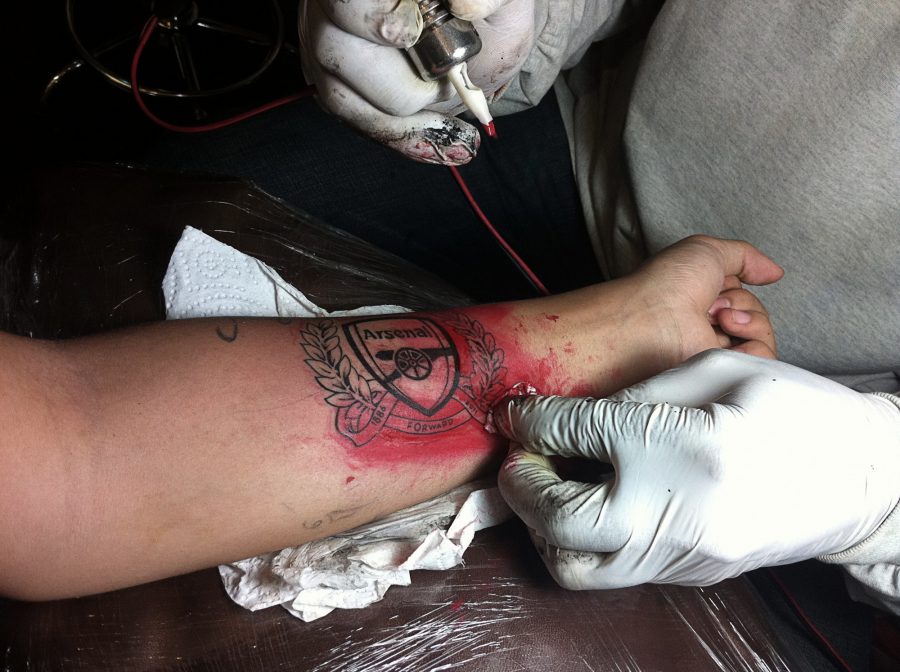 arm